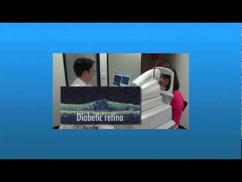 Optical Coherence Tomography