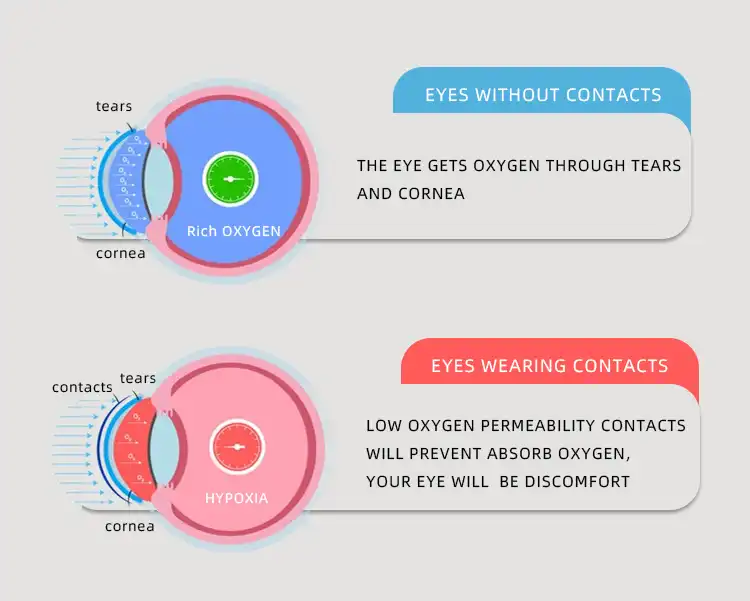 compare from eyes without contacts and wearing contacs