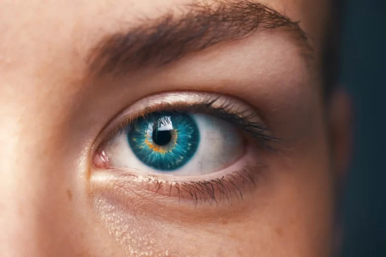 what causes colorblindess
